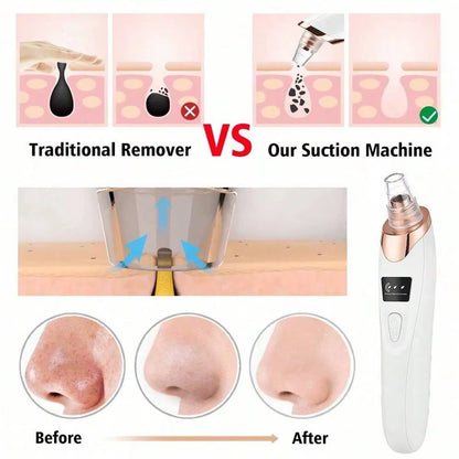 2026 Facial Pore Cleaner, 5 Suction Power Blackhead Remover Pore Vacuum - USB Rechargeable Facial Pore Cleaner Kit